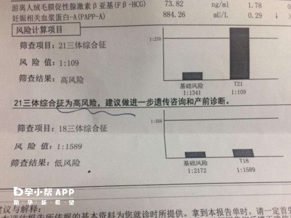 胚胎染色体13三体由遗传导致