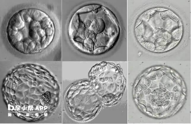 试管囊胚划分标准