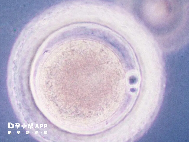 医生不建议移植2级6细胞胚胎原因