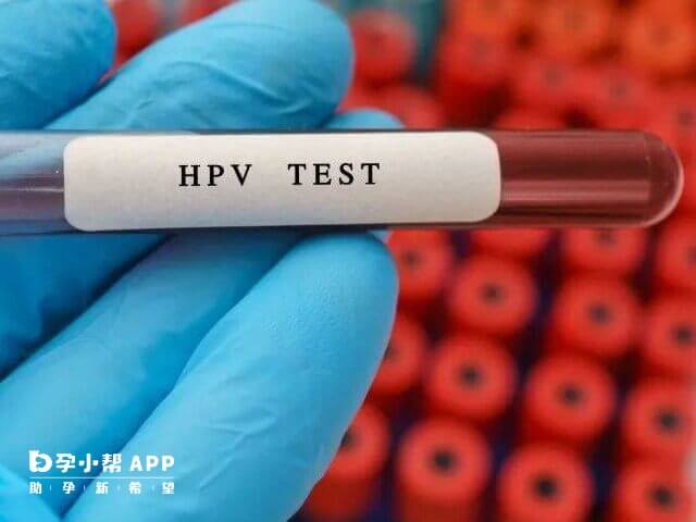 宫颈HPV52阳性不可做试管怀孕生子