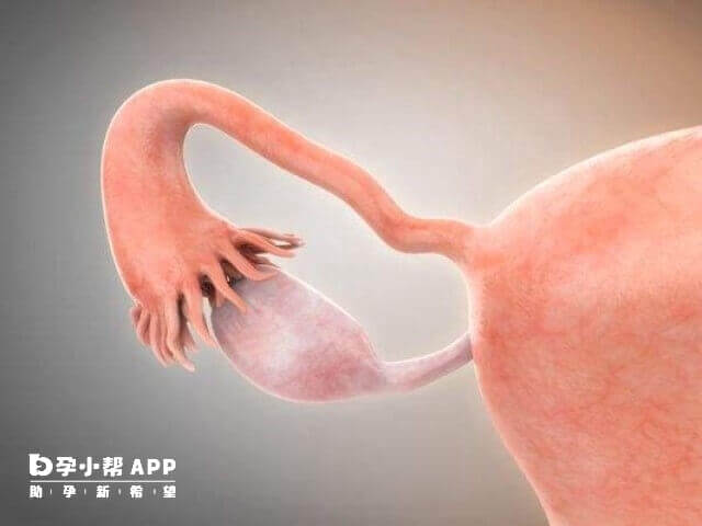 子宫腺肌症会降低试管着床成功率