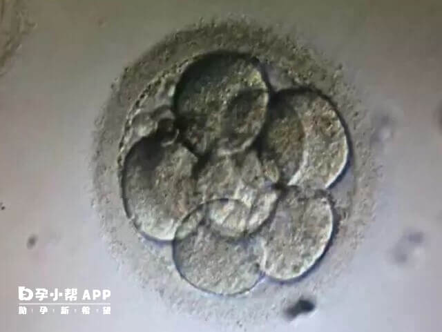 试管移植三天鲜胚最晚10天会着床成功