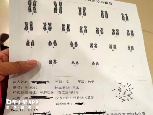 无创附加报告几率其它染色体内容