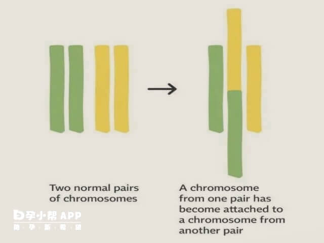 女性染色体平衡易位受遗传因素影响