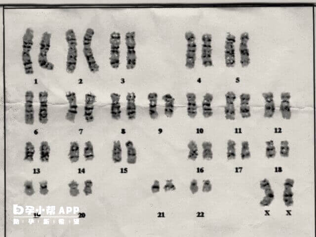 羊穿胎儿4号染色体部分缺失严重