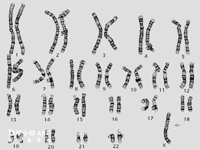 5号和8号染色体相互易位为染色体疾病