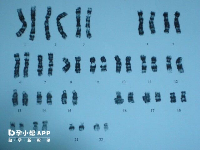 4号染色体重复片段有致病基因算严重