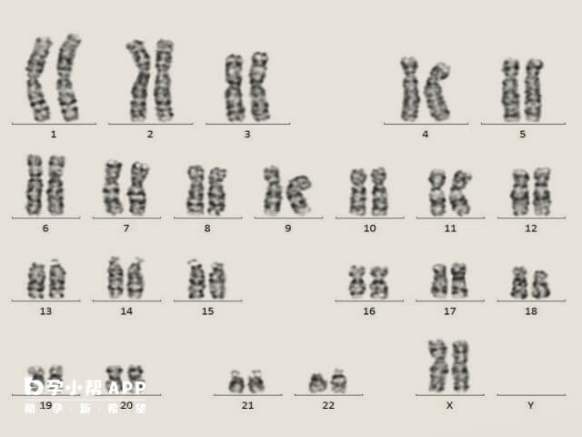 羊水穿刺结果基因芯片和核型都要看