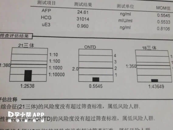 NT没问题但唐筛为临界风险严重