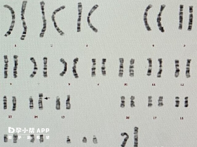 三代试管进周前要等染色体报告