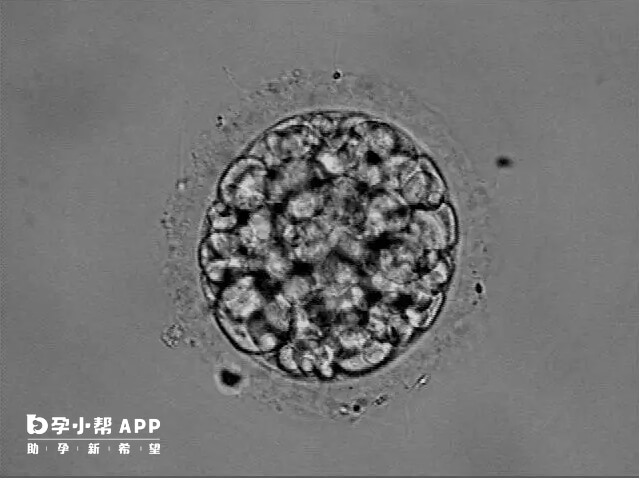 试管胚胎有鲜胚和囊胚